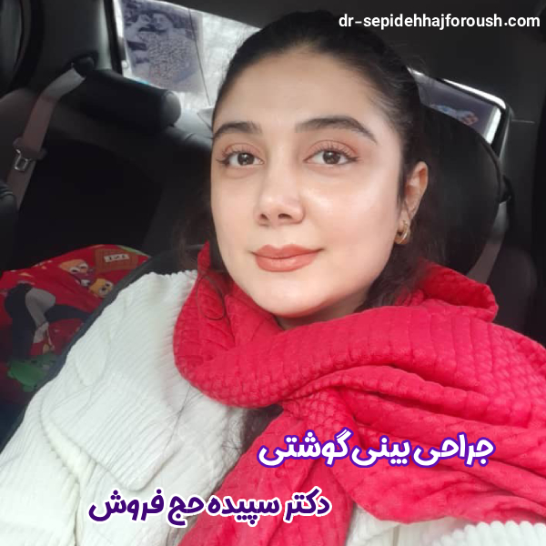 عمل بینی گوشتی - دکتر سپیده حج فروش