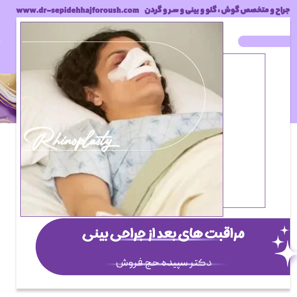 مراقبت های بعد از عمل بینی - دکتر سپیده حج فروش