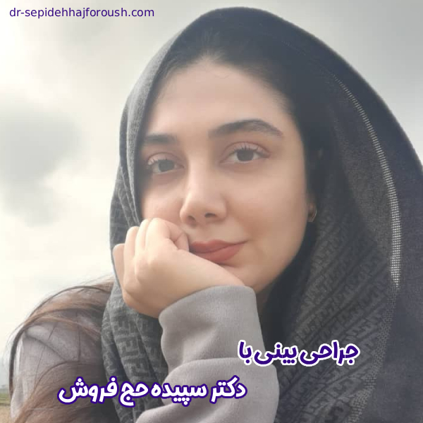 جراحی بینی - دکتر سپیده حج فروش
